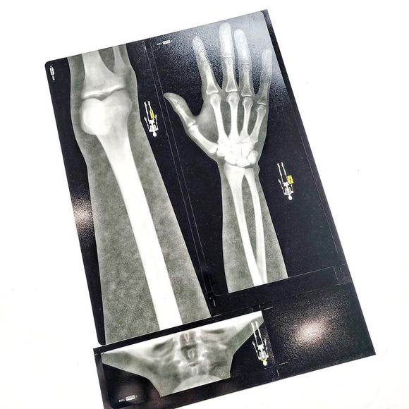 New Roylco Human Body X-Rays Montessori Learning Elementary Education - Picture 4 of 4